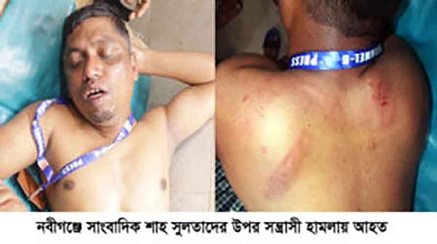 নবীগঞ্জে অনিয়মের সংবাদ প্রচারের জেরে সাংবাদিকের উপর হামলা