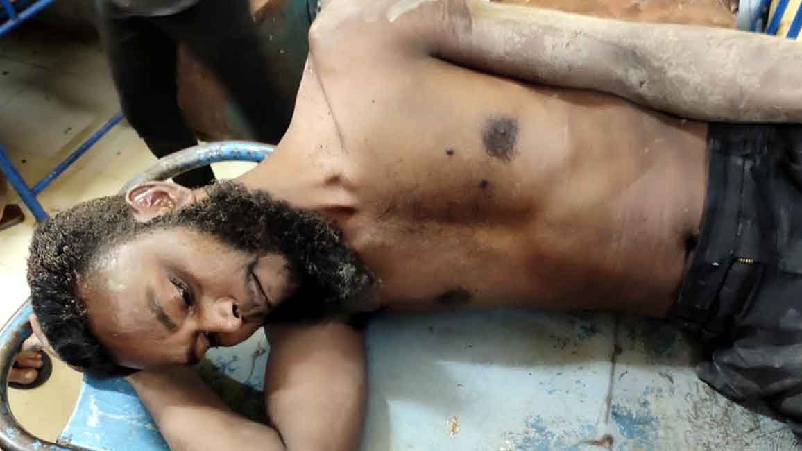 শহরে বিদ্যুতস্পৃষ্ট হয়ে আহত হয়েছে এক শ্রমিক