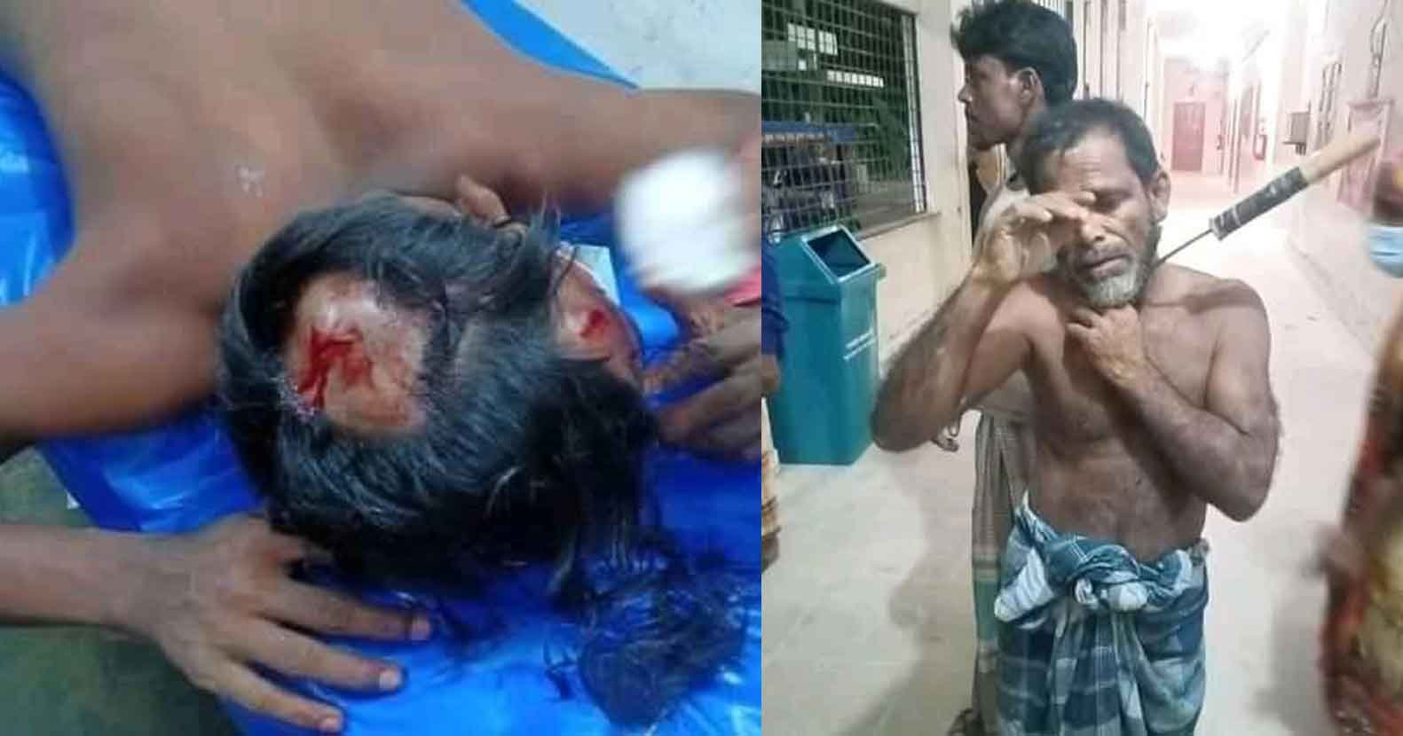 পূর্ব বিরোধের জের ধরে ফিকল বিদ্ধসহ আহত ১০, আটক ২