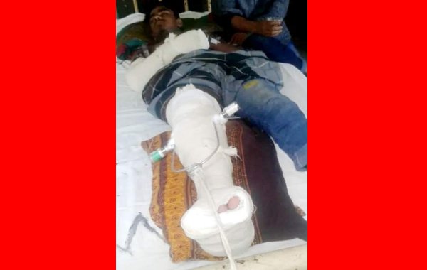 সড়ক দুর্ঘটনায় আহত মাসুম মিয়া বাচতে চায়, সাহায্য কামনা